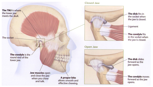 TMJ Treatment Melbourne