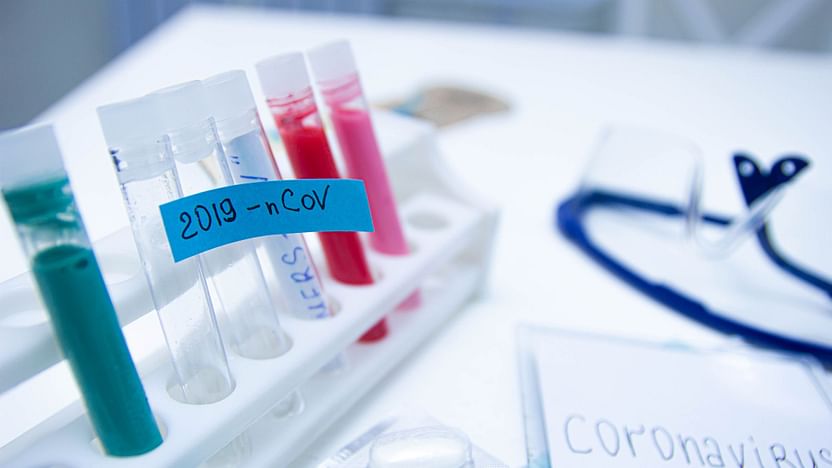 Israel serve claims ‘achievement’ in creating antibody against corona virus