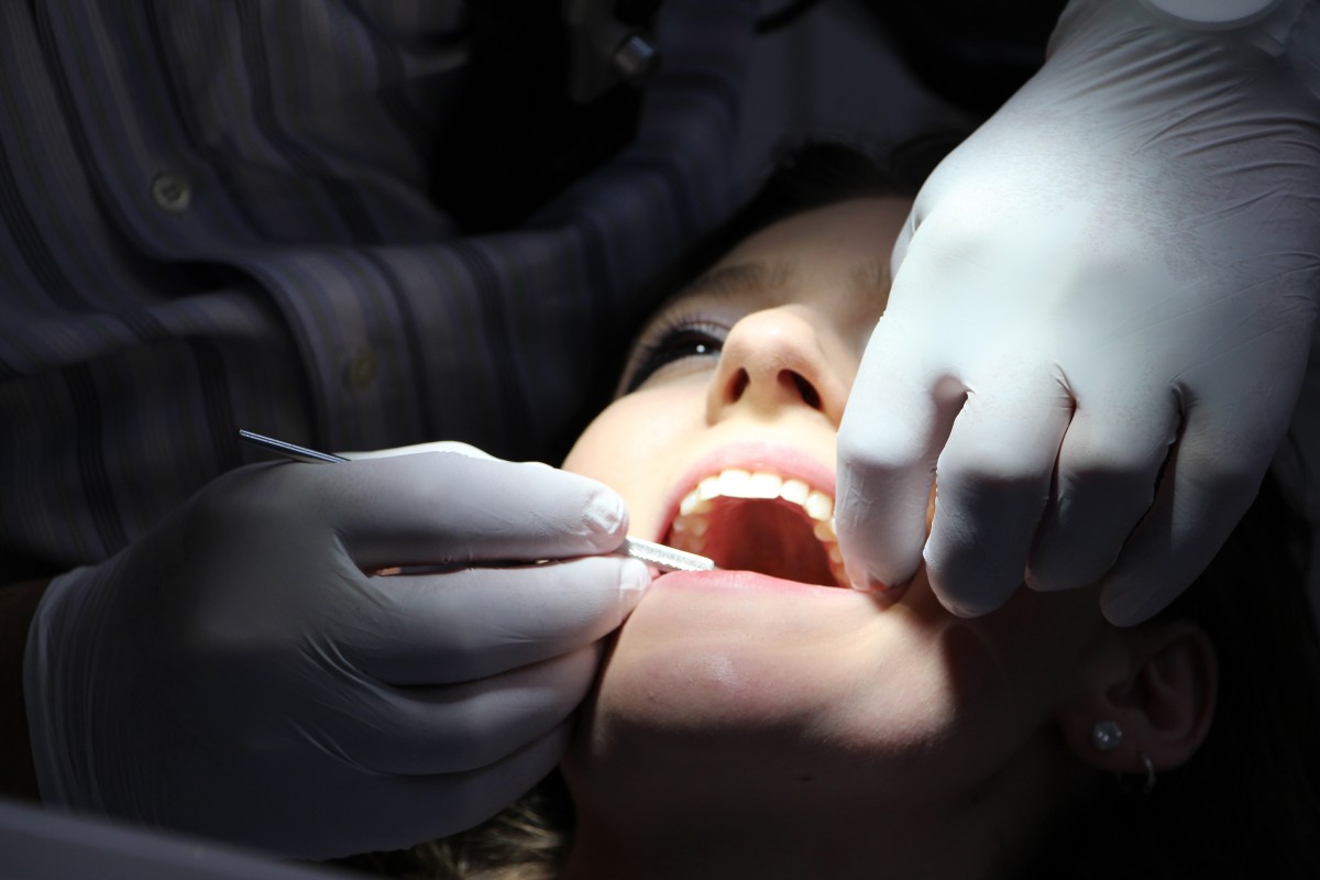 Hire Dental Professionals for Wisdom Teeth Removal Procedures