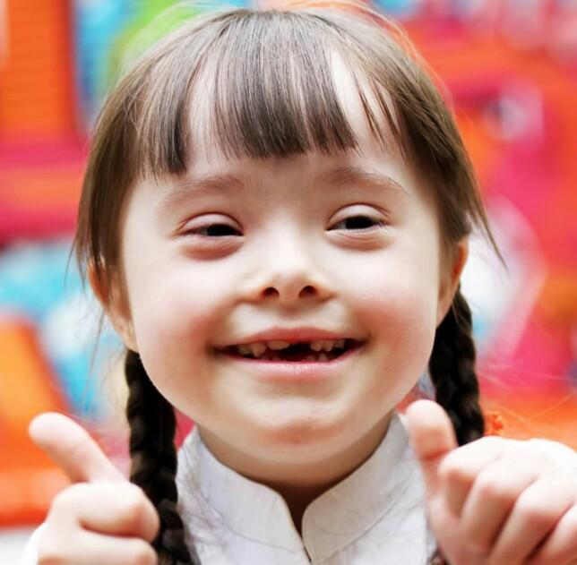 Down’s Syndrome : Overview, Symptoms and Diagnosis